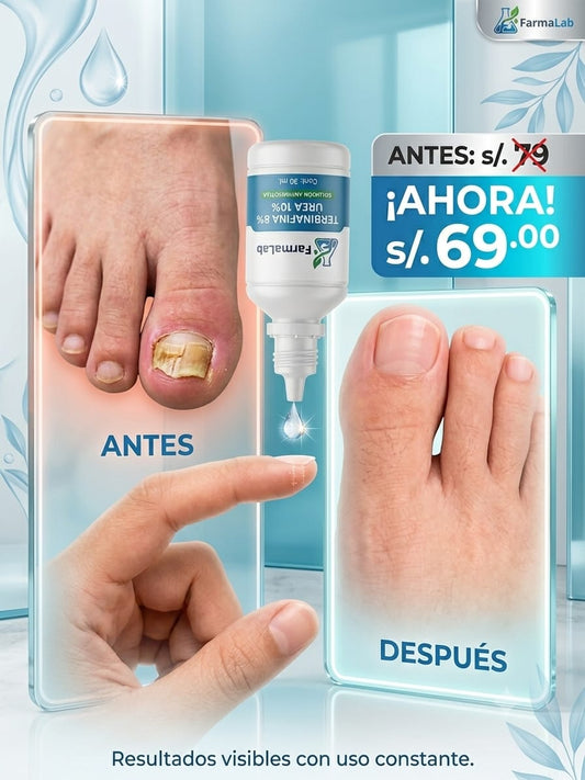 Packs Gotas Terbinafina